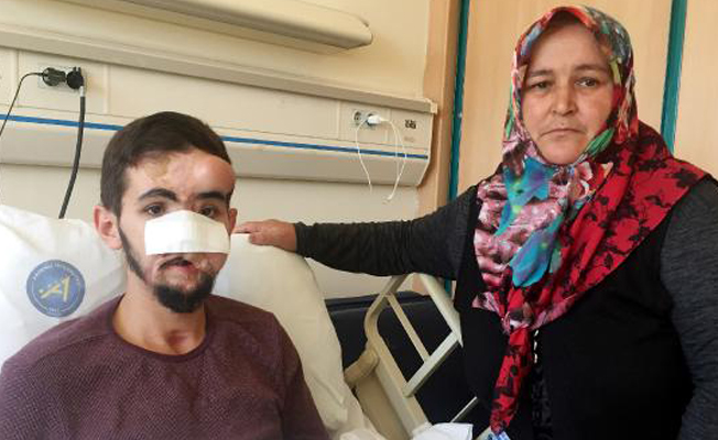 Yüzüne ateş eden genç, 37'nci kez ameliyat olacak Yüzüne ateş eden genç, 37'nci kez ameliyat olacak