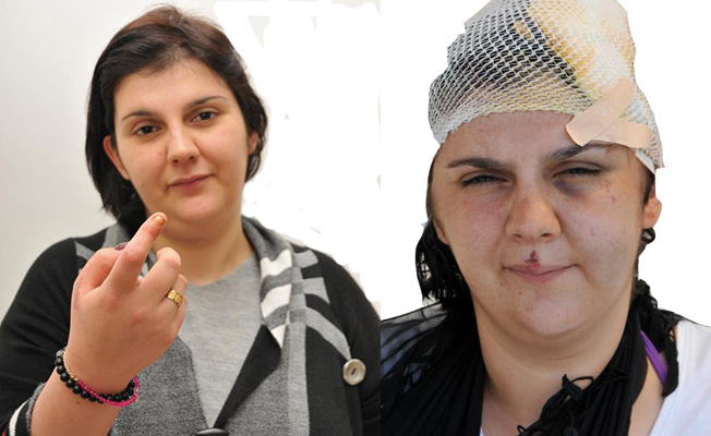 kol kirip bas yaran ese 8 yil 9 ay hapis guney haberci antalya nin bir numarali haber portali