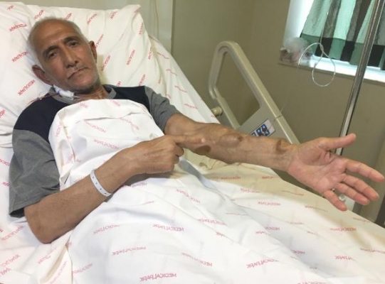 Adana'da 18 yıldır beklediği böbreğe, Antalya’da 49 günde kavuştu