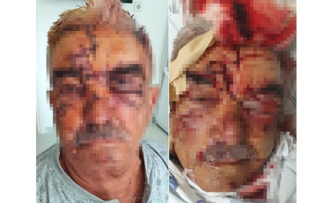 Beslediği komşusunun köpeğinin saldırısına uğradı Beslediği komşusunun köpeğinin saldırısına uğradı