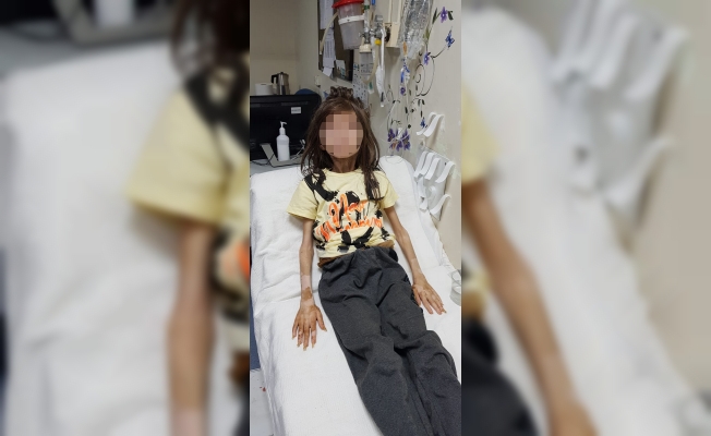 Bursa’da evde kilitli bulunan çocuk, Antalya AÜ Hastanesi’nde tedaviye alındı