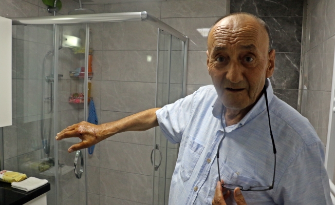 Patlayan duş kabininde yaralandı, 1 aydır direksiyon başına geçemiyor