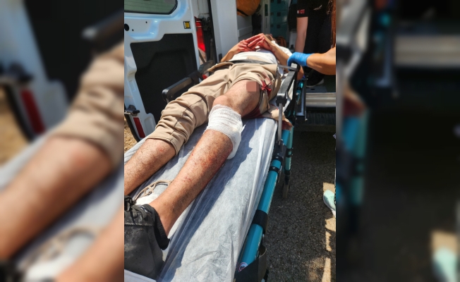 Tartıştığı kişiyi bacağından vurdu, başında bekledi Tartıştığı kişiyi bacağından vurdu, başında bekledi