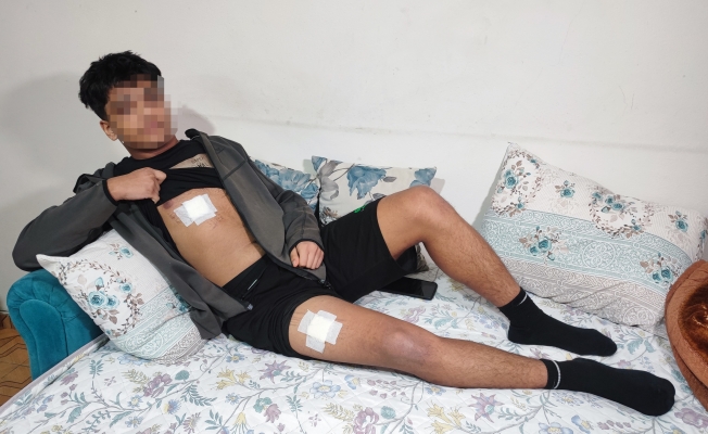 Akran zorbalığı az kalsın öldürüyordu: Önce dövüldü sonra bıçaklandı!