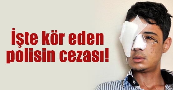 İşte kör eden polisin cezası!