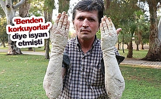 23 yıldır hastalıkla mücadele ediyordu... İşte son hali!