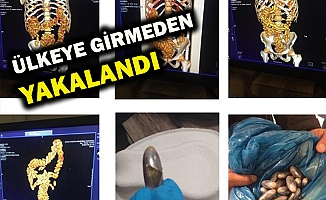 MİDE VE BAĞIRSAKLARINDAN 400 KAPSÜL ÇIKTI!