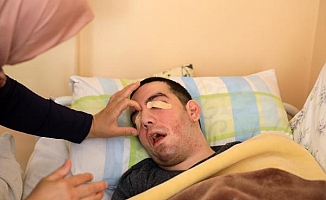 Yatalak oğlunun gözlerini 6 yıldır yara bandıyla kapatıyor