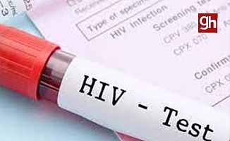 "2010'dan bu yana HIV ile yaşayan birey sayısı 9 kat arttı"