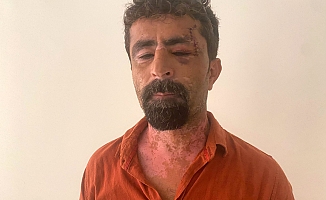  Antalya'da öfkeli damat kayınpederini hastanelik etti