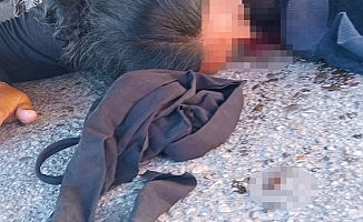 Yolun karşısına geçen yaya, çöp kamyonunu altında kaldı!