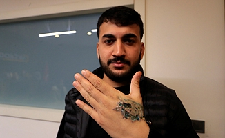  Dövme sildirmek isterken kabusu yaşadı, elindeki dokular öldü