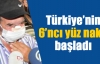 Türkiye'nin 6'ncı yüz nakli başladı