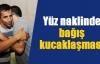 Yüz naklinde bağış kucaklaşması