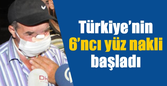 Türkiye'nin 6'ncı yüz nakli başladı