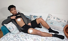 Akran zorbalığı az kalsın öldürüyordu: Önce dövüldü sonra bıçaklandı!