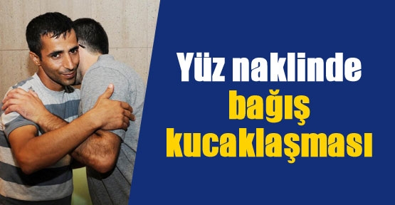 Yüz naklinde bağış kucaklaşması